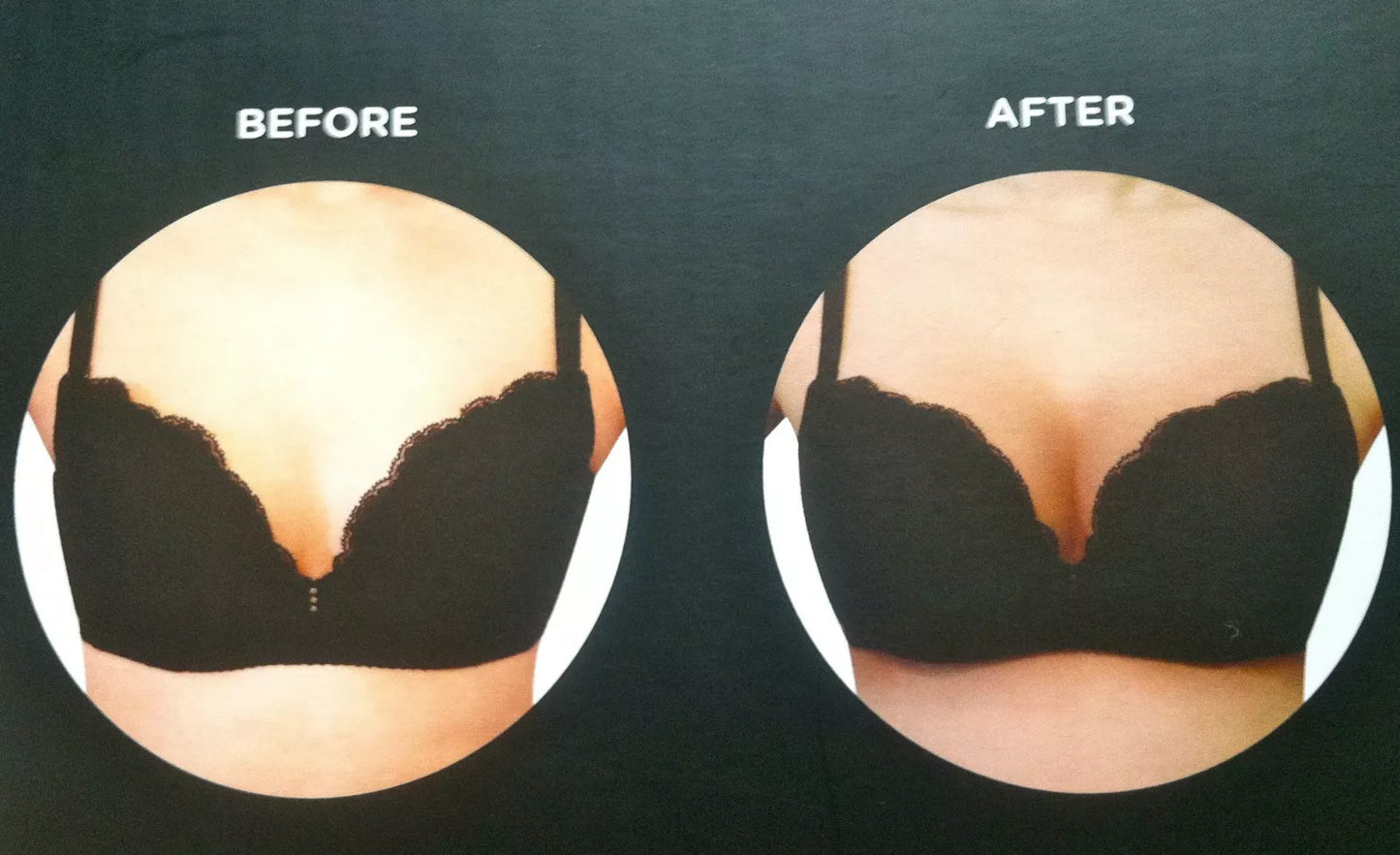 Envy Body Shop Silicone Breast Enhancer Concave Back with Adhesive Pad
