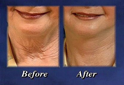 Bring It Up Instant Neck Lift Adhesive, One Pack of 30 Day Supply